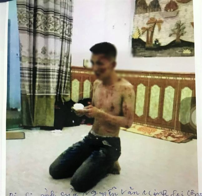 Triệt phá tổ chức tín dụng đen lớn nhất nước tra tấn nhân viên như thời trung cổ Triet pha to chuc tin dung den lon nhat nuoc tra tan nhan vien nhu thoi trung co