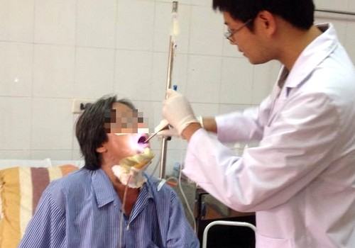 Tạo lưỡi mới cho bệnh nhân 57 tuổi