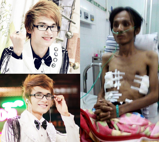 Giành giật sự sống với bệnh lao phổi