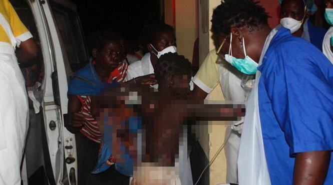 Một bé trai bị thương trong vụ nổ được đưa tới bệnh viện tỉnh Tete - Ảnh: AFP