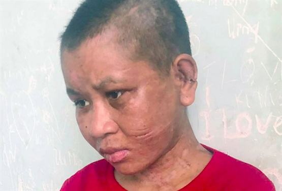 Đề nghị xử lý nghiêm người làm thuê bị bạo hành ở Gia Lai