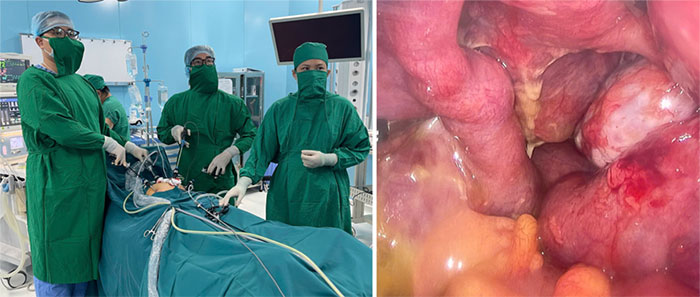 TP.HCM: Bệnh nhân tại Côn Đảo được xử trí thành công ca áp xe ống dẫn trứng hai bên