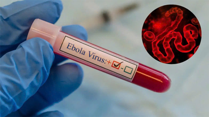 TP.HCM siết chặt giám sát cửa khẩu trước nguy cơ dịch Ebola xâm nhập